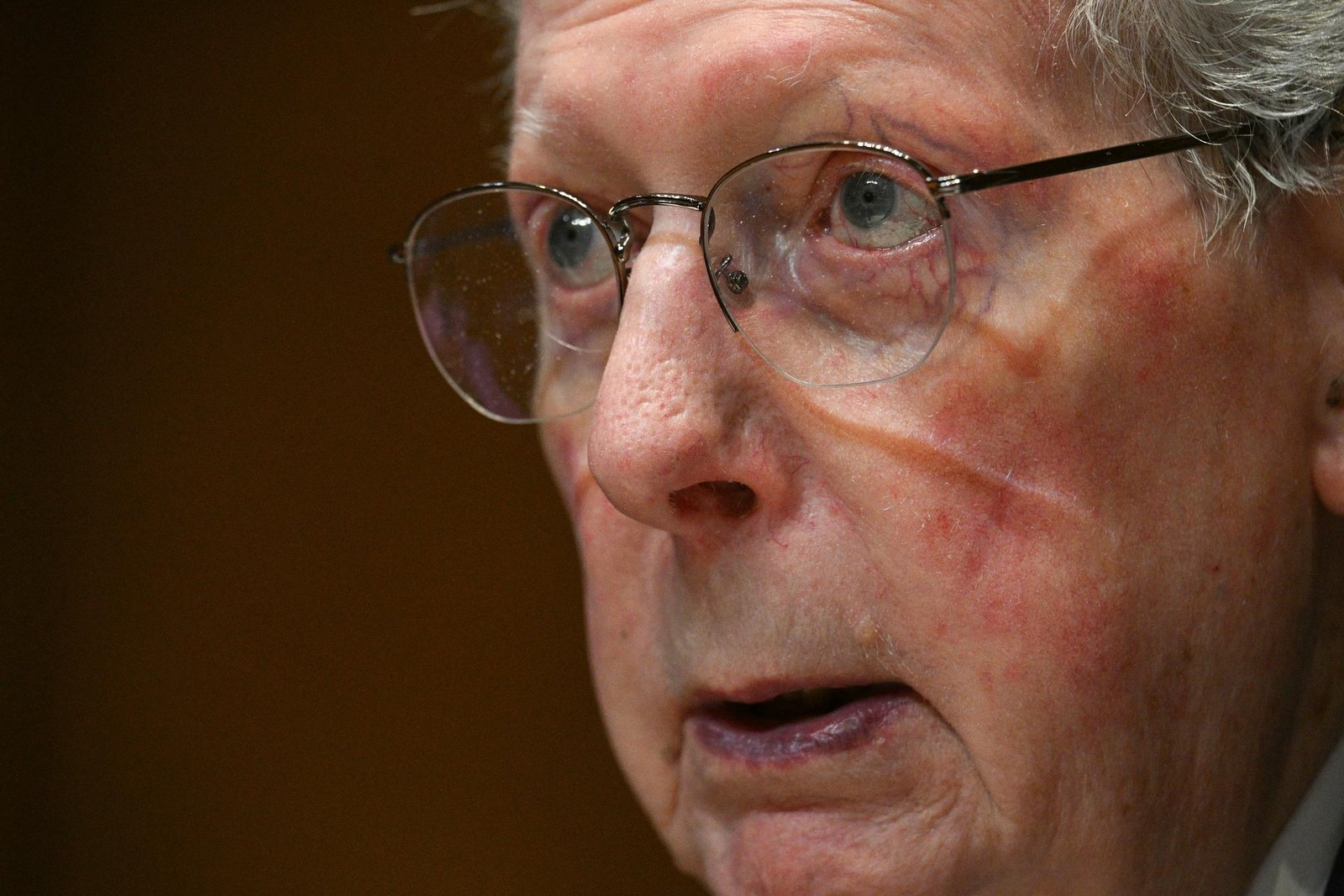McConnell insisted he suffered no broken bones, concussions, strokes, tumors, or hemorrhages. He stated that he was continuing his work remotely on appropriations and midterm politics before his upcoming January retirement.